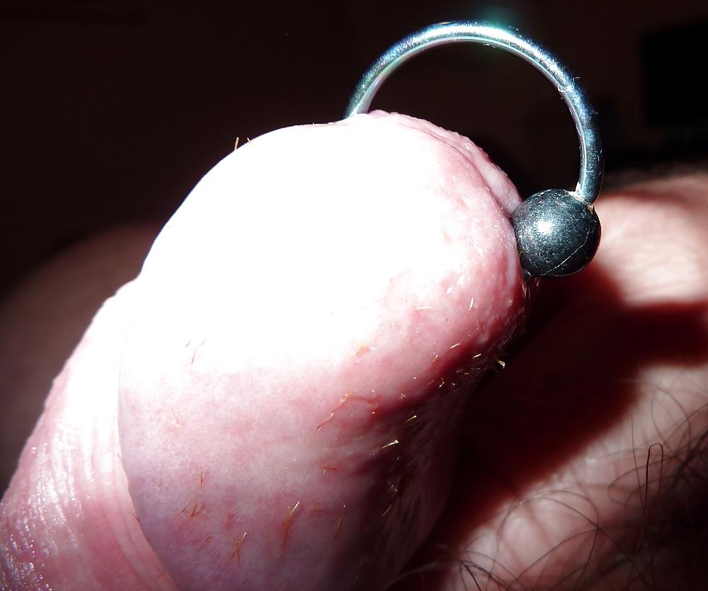 5P 72 hours LESS SPLINTERS BUT PAIN IS EXCRUCIATING