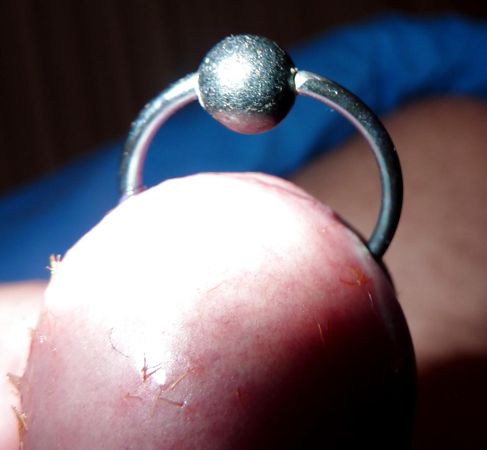 5P 72 hours LESS SPLINTERS BUT PAIN IS EXCRUCIATING