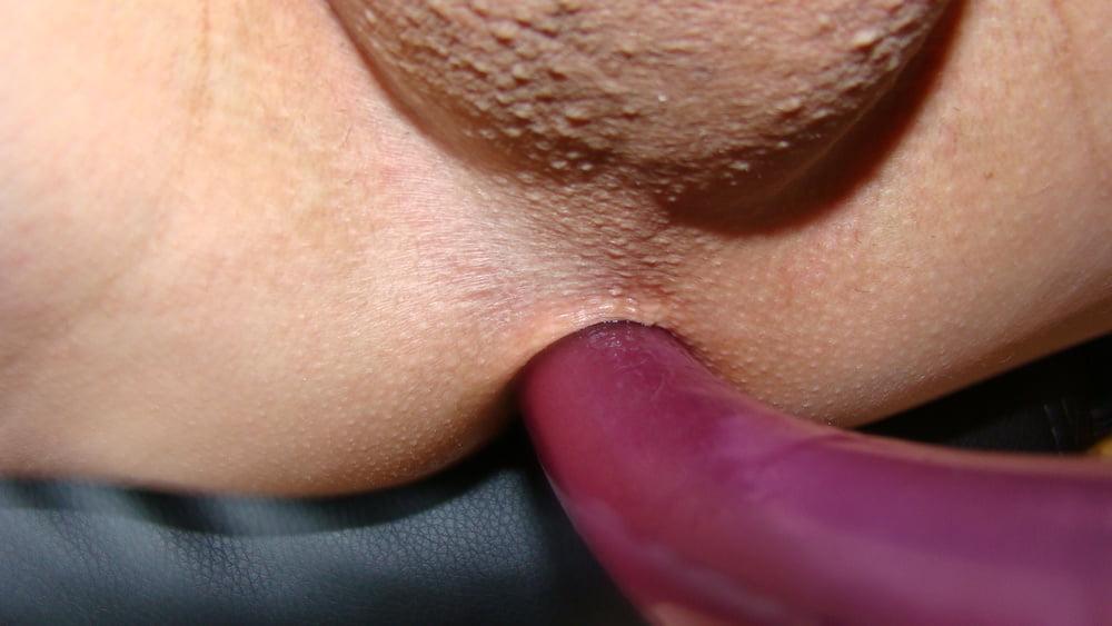 24P Anal