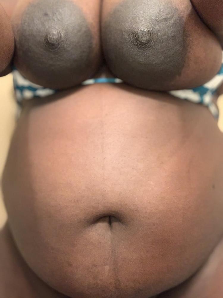 25P Pregnancy and Wet