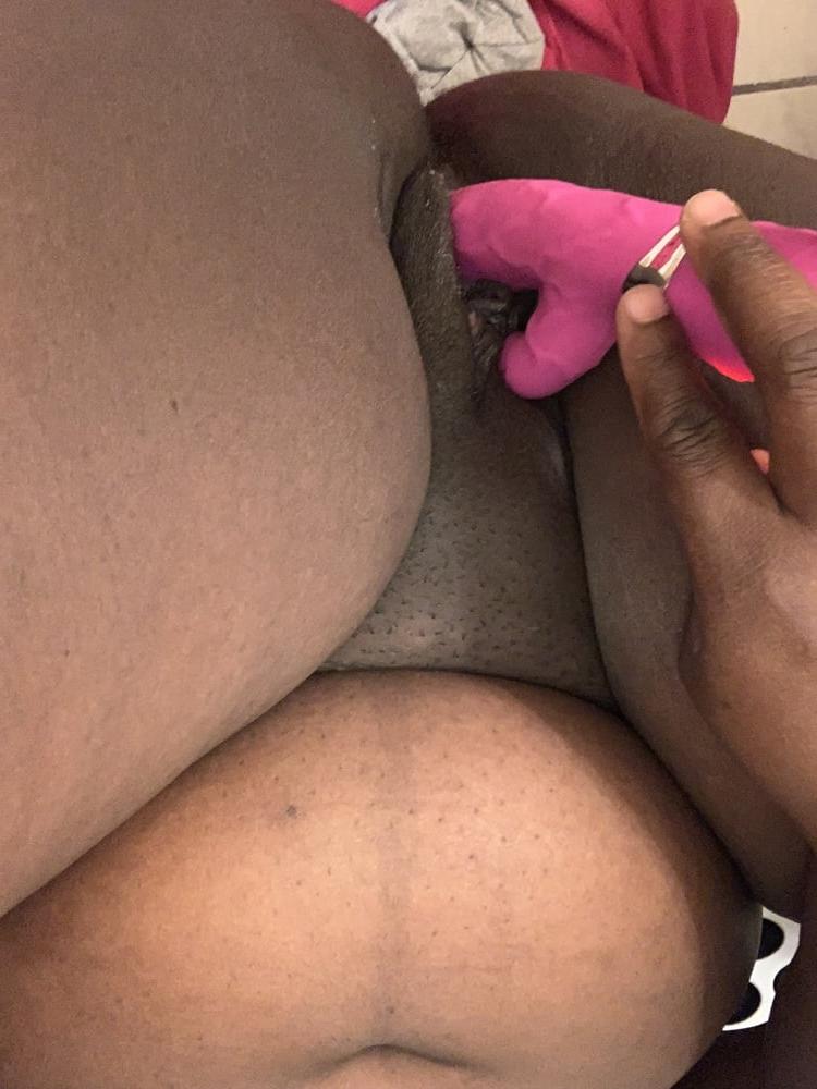 25P Pregnancy and Wet