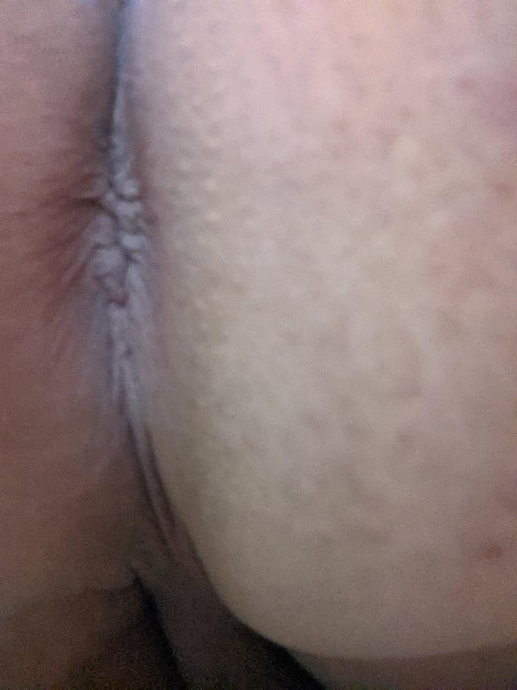 17P Ass Pictures #2 still need a dick destroing it!