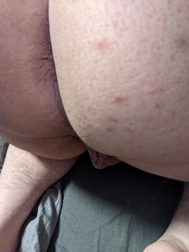 17P Ass Pictures #2 still need a dick destroing it!
