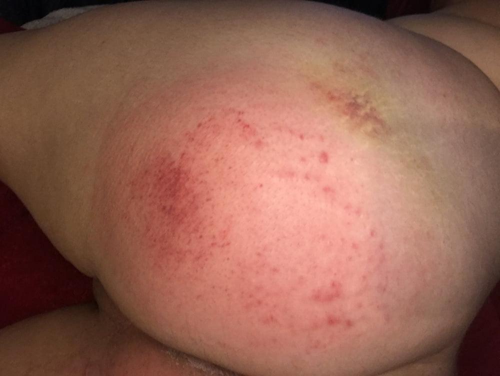 8P Posting my bottom after I'm punished