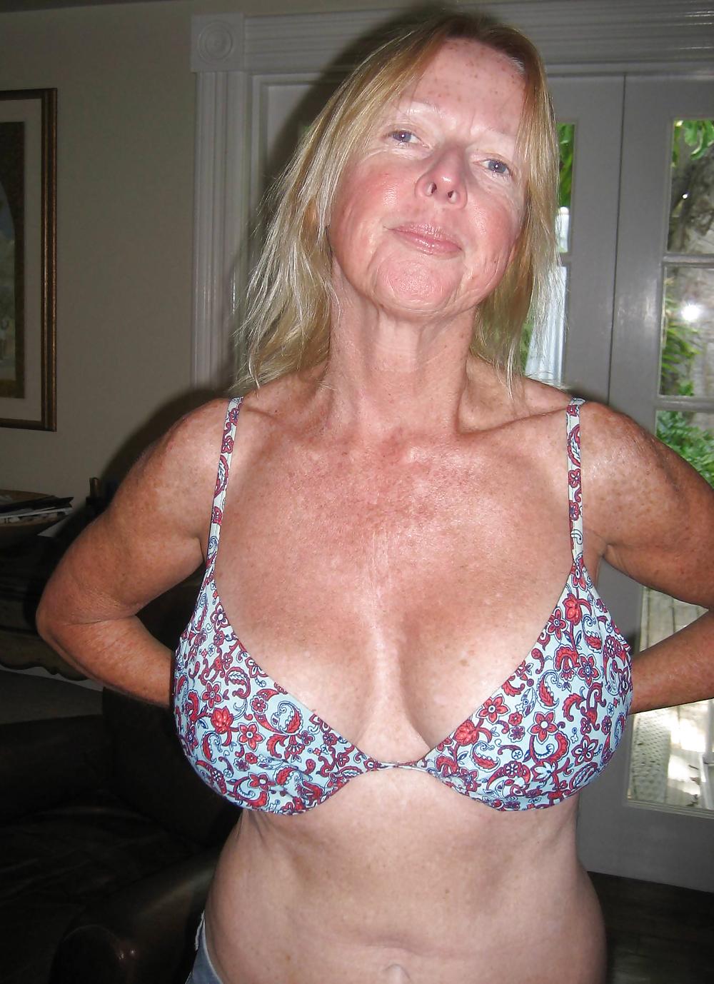 16P Freckled granny