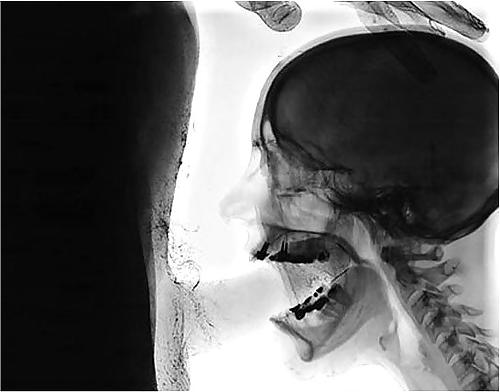 25P X-Rayed Sex