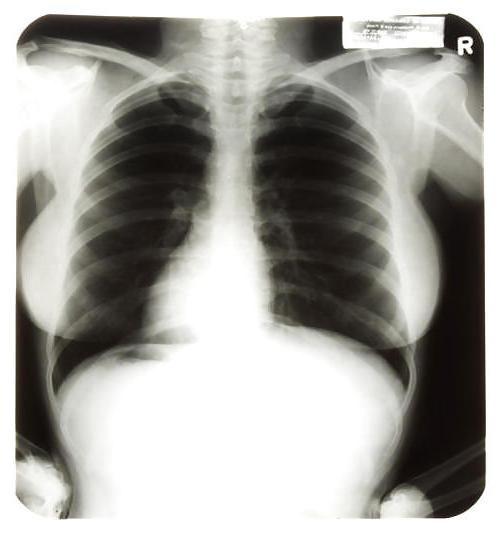 25P X-Rayed Sex