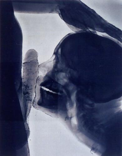 25P X-Rayed Sex