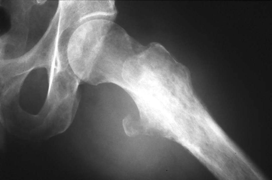 25P X-Rayed Sex