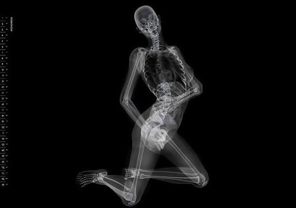 25P X-Rayed Sex