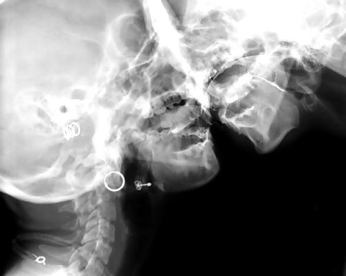 25P X-Rayed Sex