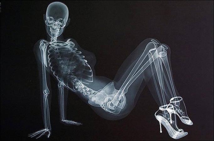 25P X-Rayed Sex