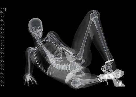 25P X-Rayed Sex