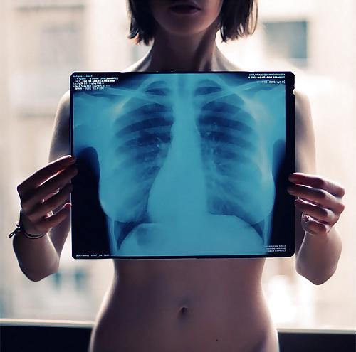 25P X-Rayed Sex