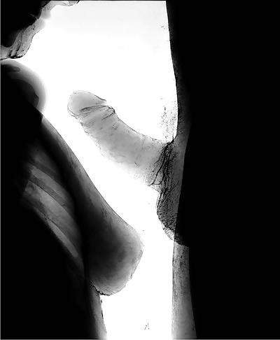 25P X-Rayed Sex