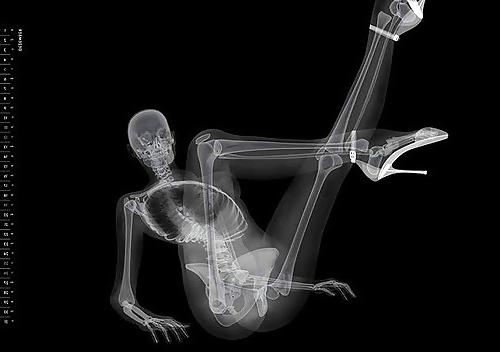 25P X-Rayed Sex