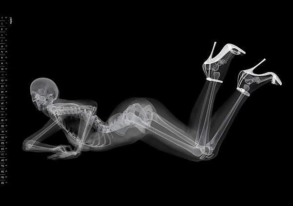 25P X-Rayed Sex