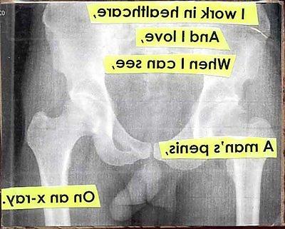 25P X-Rayed Sex