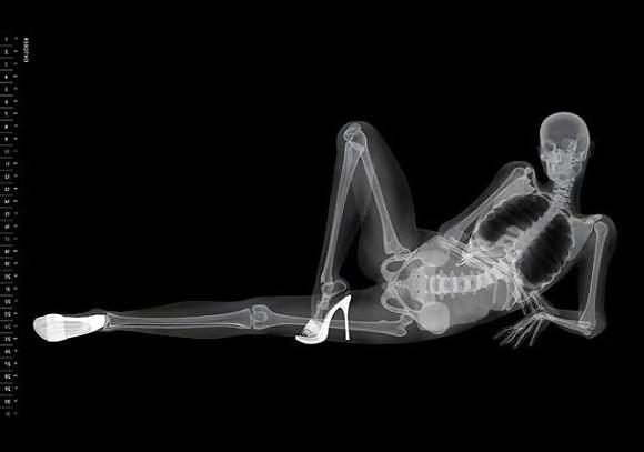 25P X-Rayed Sex