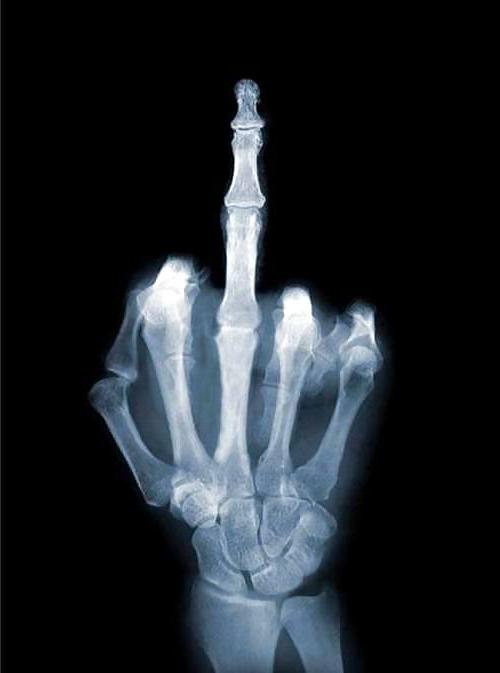 25P X-Rayed Sex