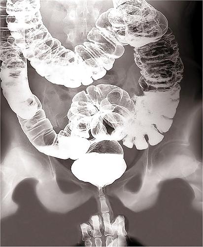 25P X-Rayed Sex