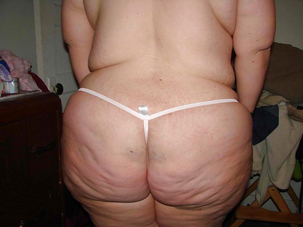 25P Thick, White, and Cellulite 19