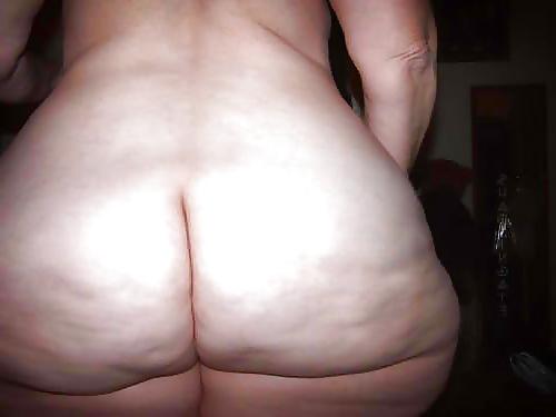 25P Thick, White, and Cellulite 20