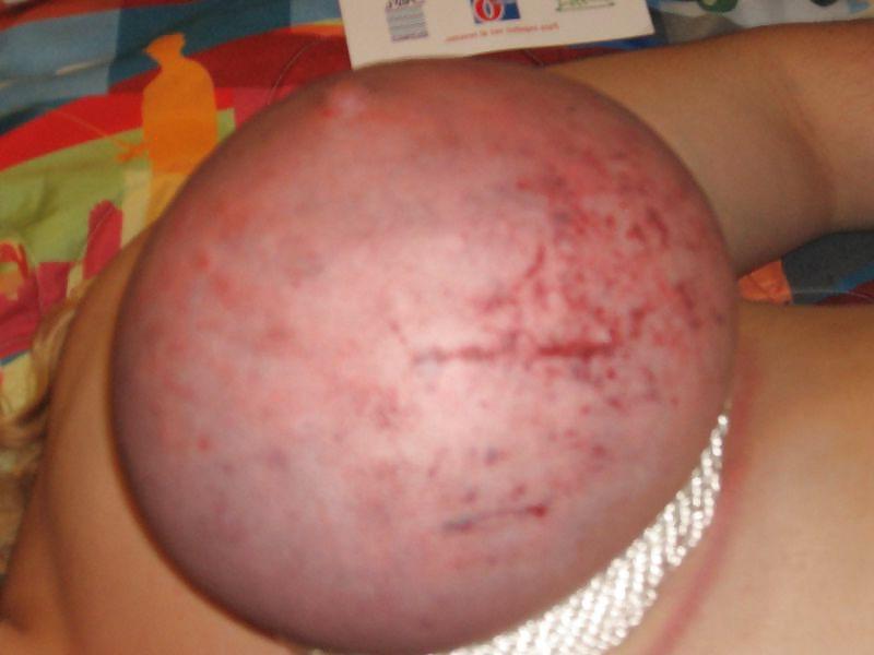 25P Fun night with a little pain
