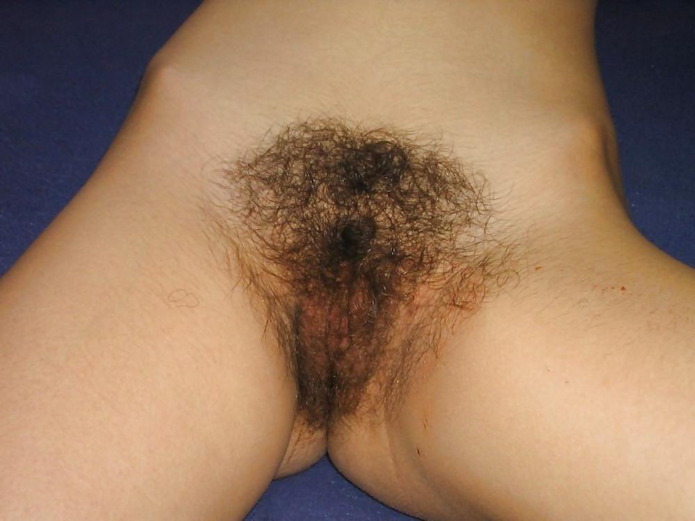 15P French hairy chick