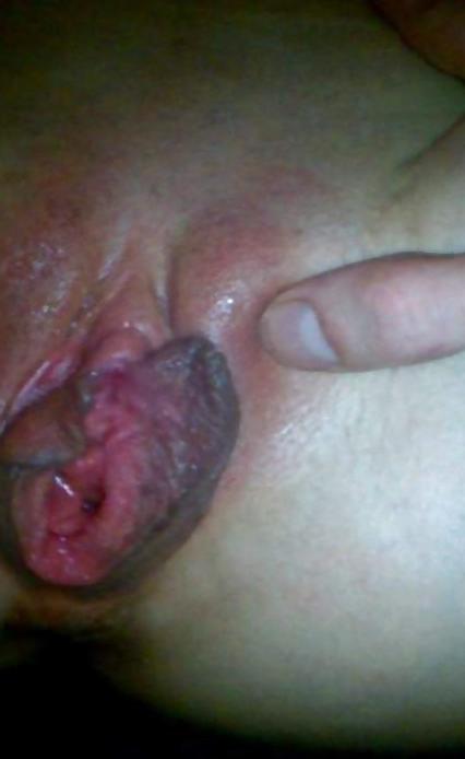 6P MY DIRTY OPENED LABIA AFTER GANGBANG WITH 35 STUDS