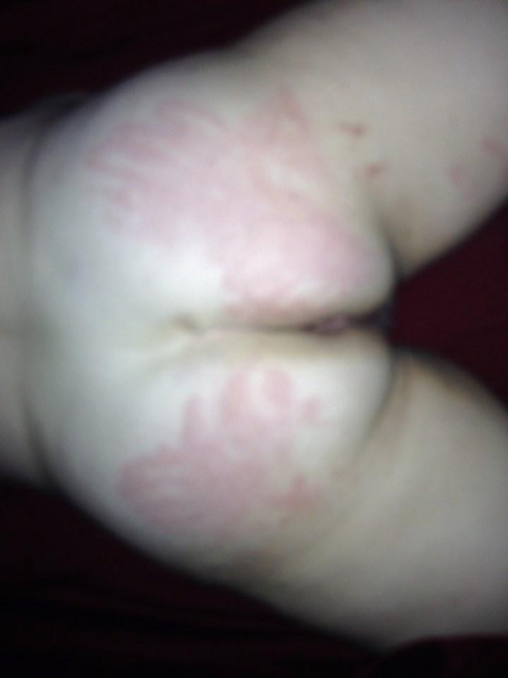 11P Pain Slut