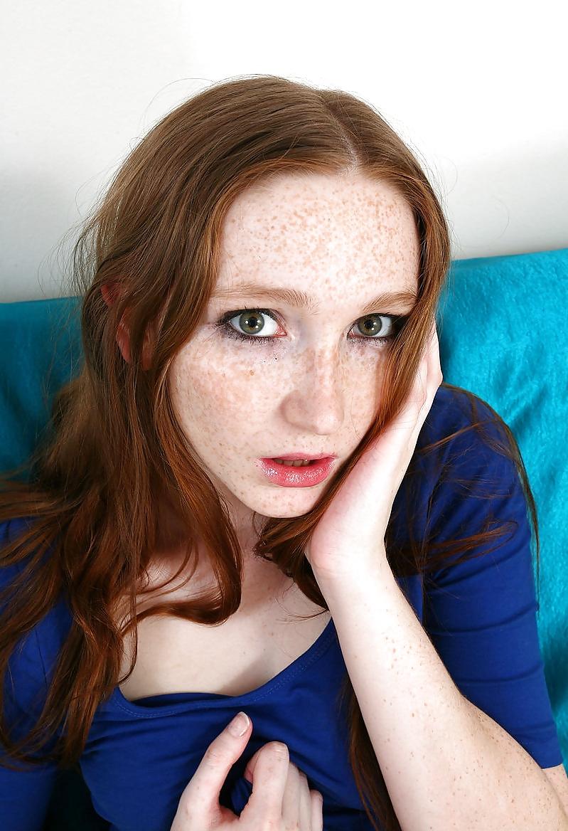 25P FRECKLES REDHEAD 