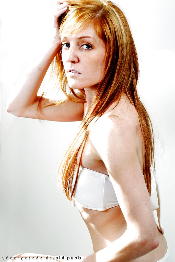 25P Redheads and Freckles 2 of 4 