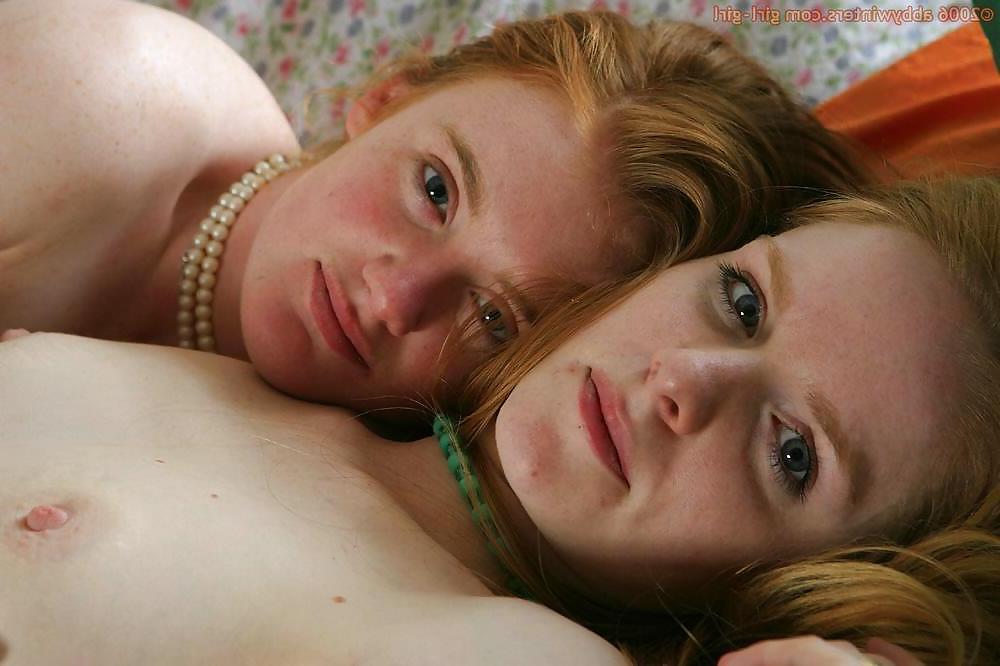 25P Redheads and Freckles 2 of 4 