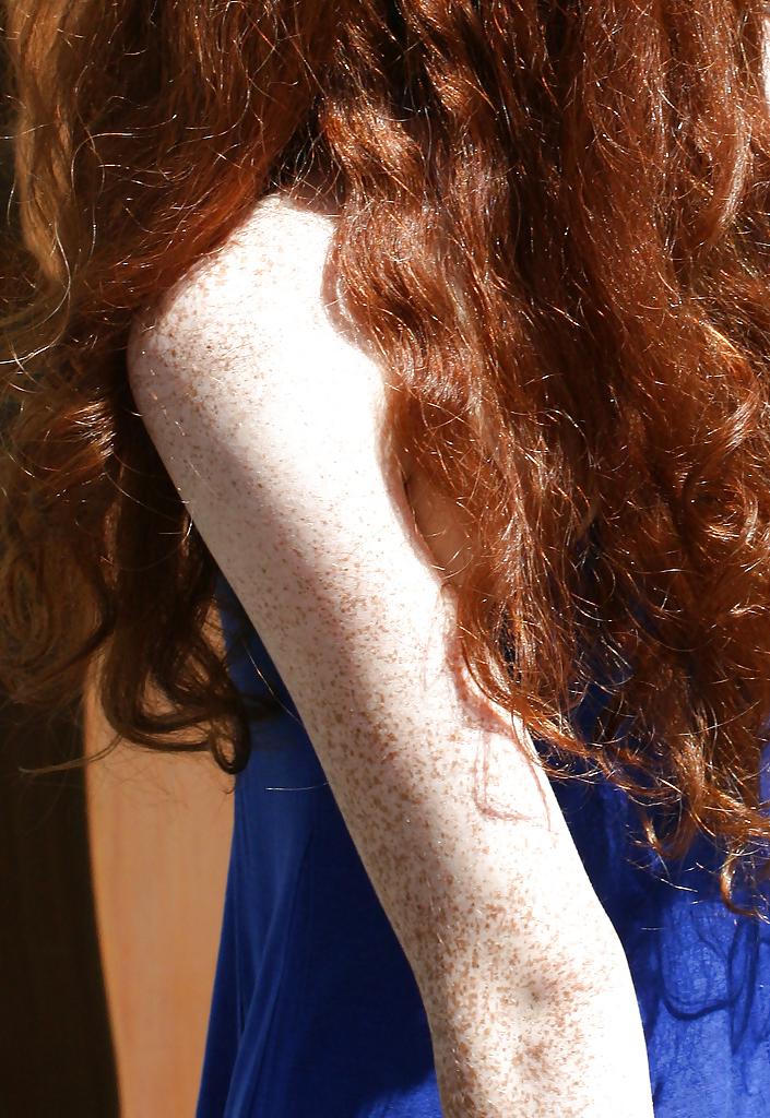 25P Redheads and Freckles 2 of 4 