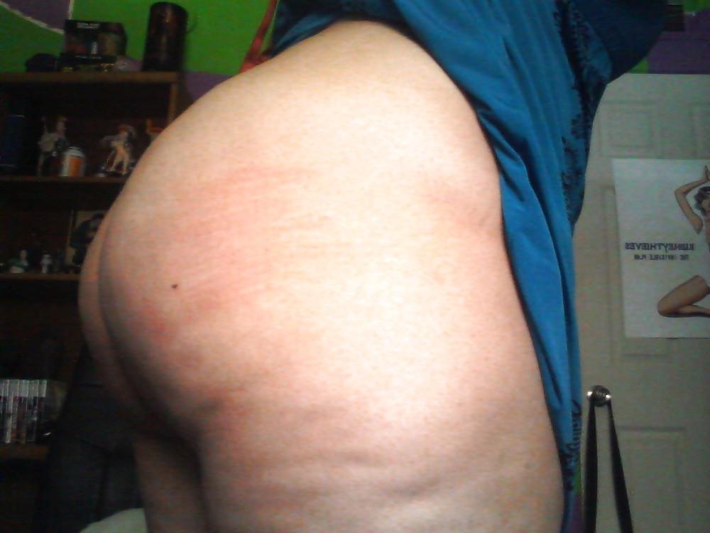 25P Thick, White, and Cellulite 24