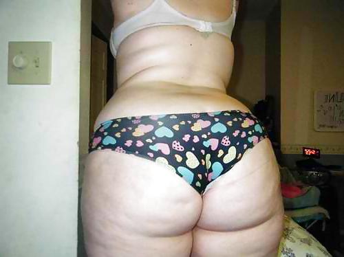 25P Thick, White, and Cellulite 3