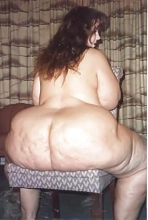 25P Thick, White, and Cellulite 11
