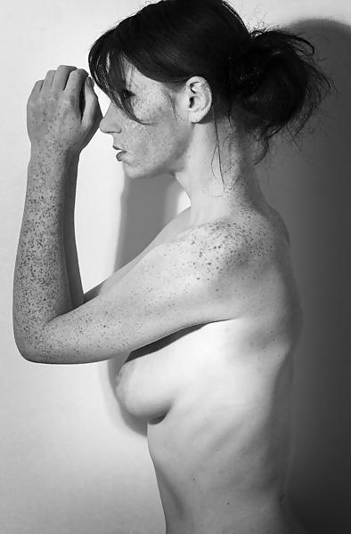 25P Freckles....
