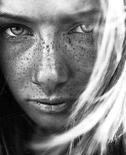 25P Freckles....