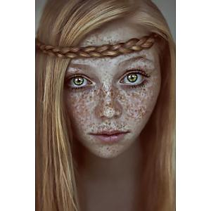 25P Freckles....