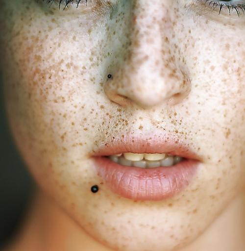 25P Freckles....