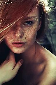 25P Freckles....