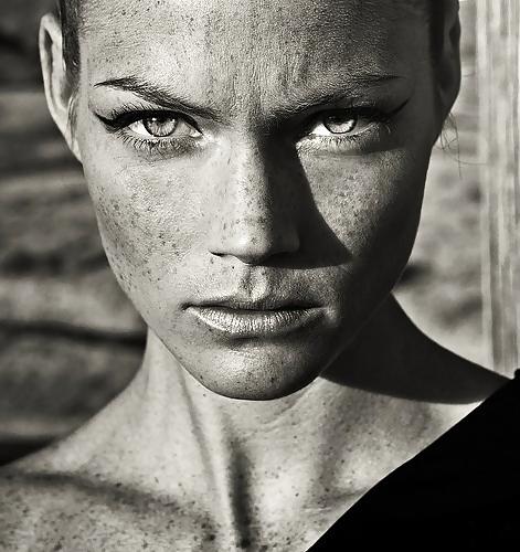 25P Freckles....