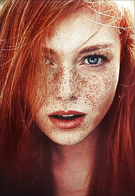 25P Freckles....