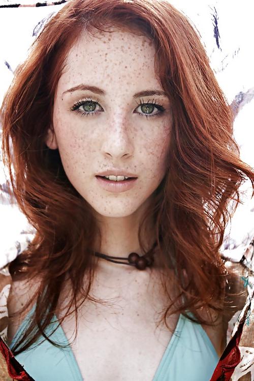 25P Freckles....