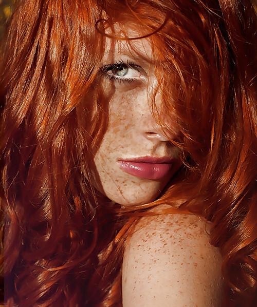 25P Freckles....