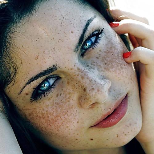 25P Freckles....