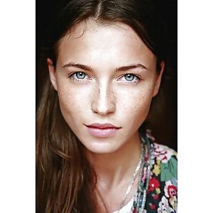 25P Freckles....