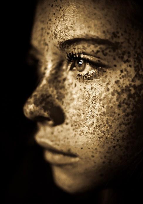 25P Freckles....